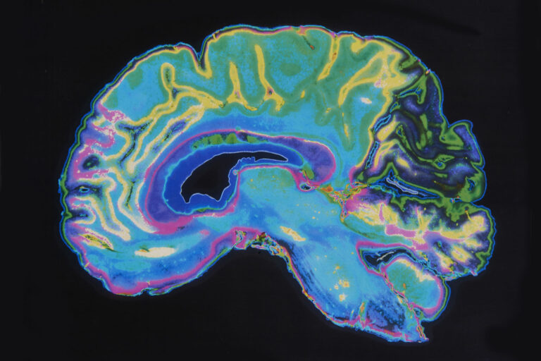ET SI NOTRE CERVEAU ÉTAIT EN RÉALITÉ… DEUX ORGANES?