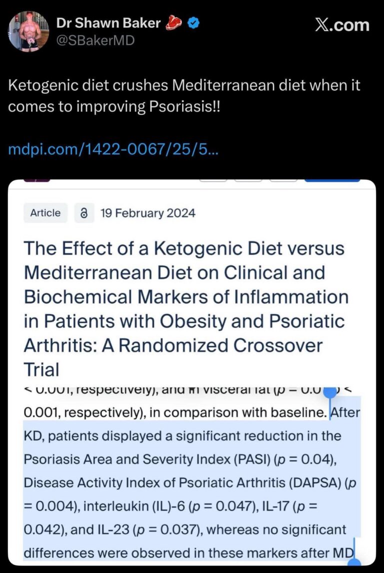 Une étude en 2024 démontre que la nutrition cétogène est excellente pour réduire les symptômes de psoriasis, la maladie inflammatoire de la peau. Tandis que la nutrition méditerranéenne n&rsquo;a aucun effet.